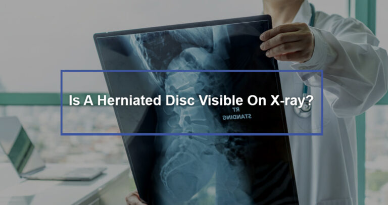 Is A Herniated Disc Visible On X Ray Dr Kevin Pauza The Discseel