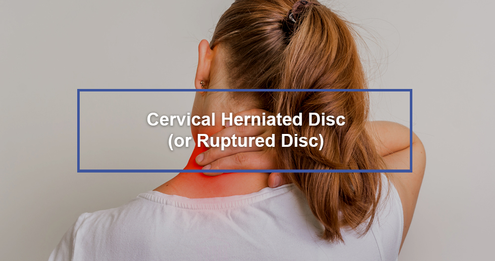 Cervical Herniated Disc