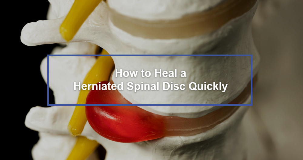 Heal a Herniated Spinal Disc Quickly