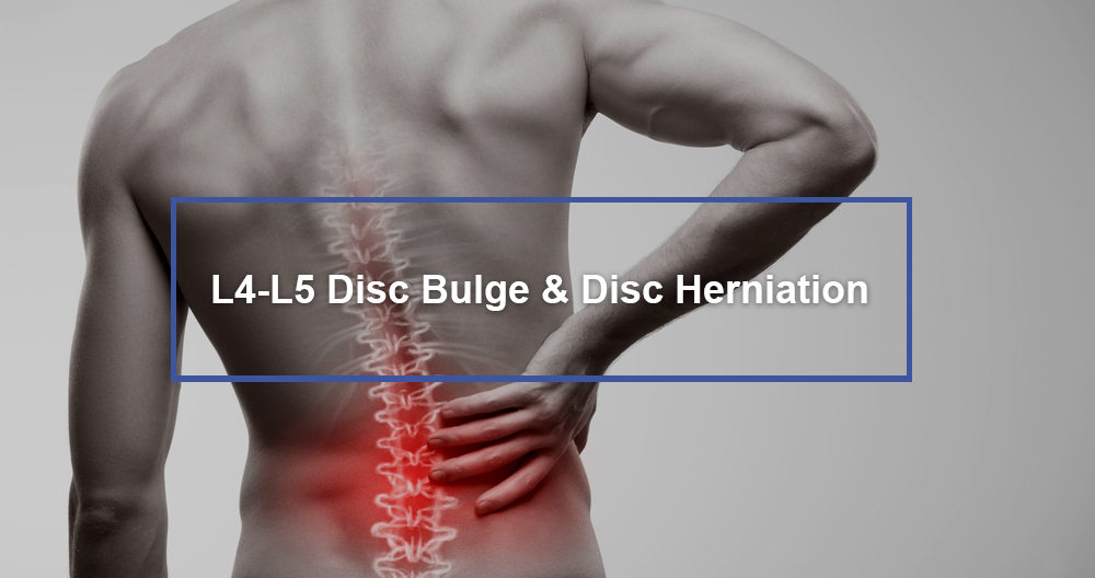 L4-L5 Disc Bulge & Disc Herniation