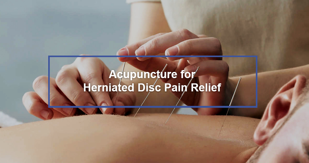 Acupuncture for Herniated Disc Pain Relief - Dr. Kevin Pauza