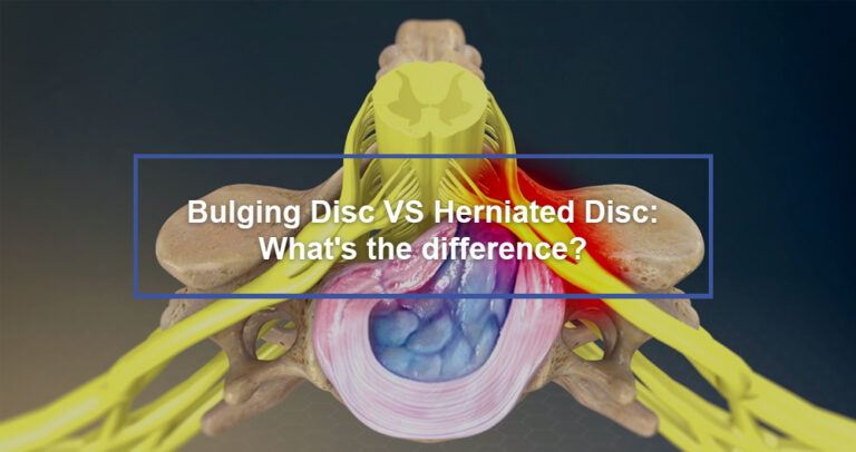 Bulging Disc Vs Herniated Disc Whats The Difference Dr Kevin Pauza