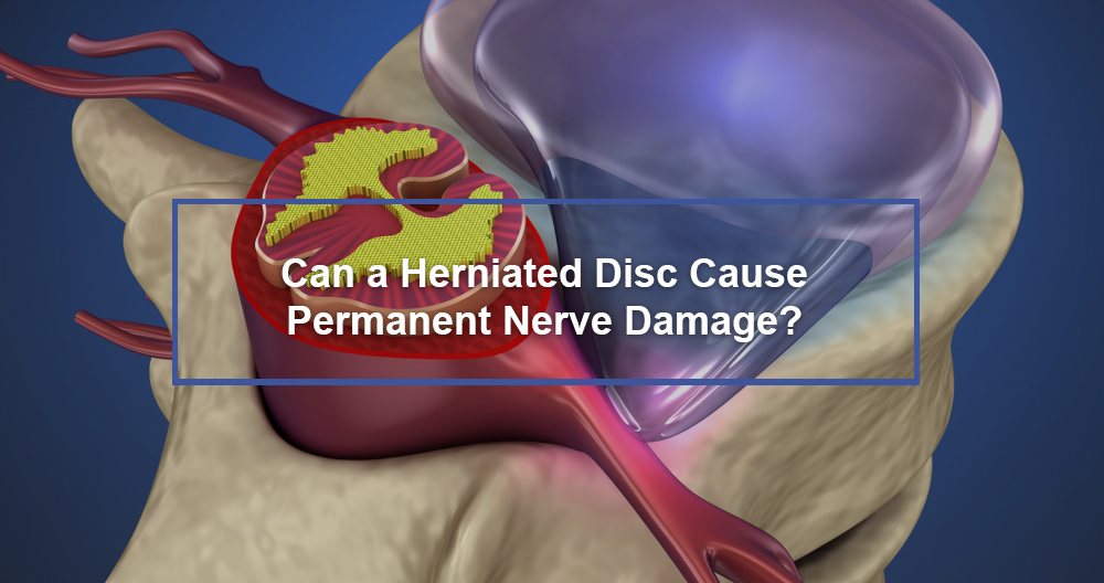 Can a herniated disk cause permanent damage?