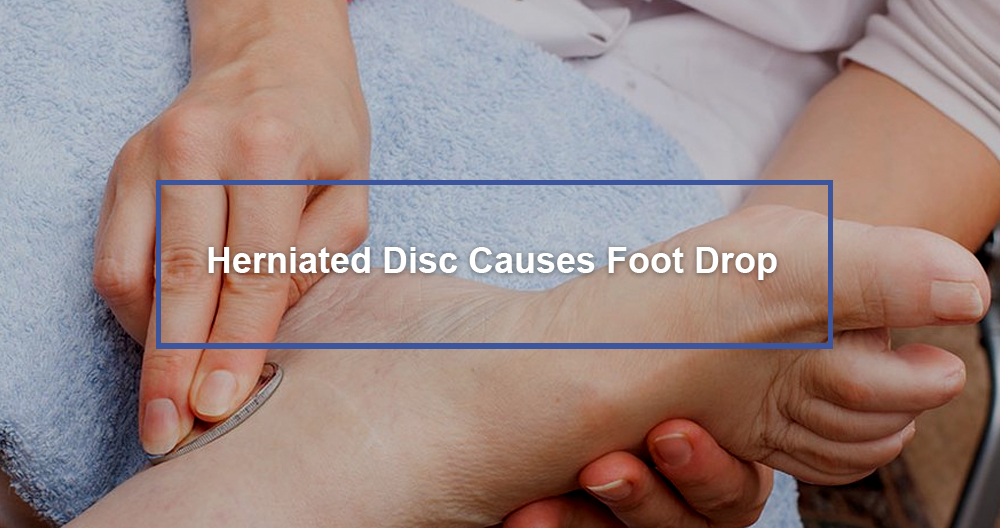 Herniated Disc Causes Foot Drop