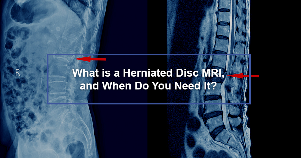 Herniated Disc MRI