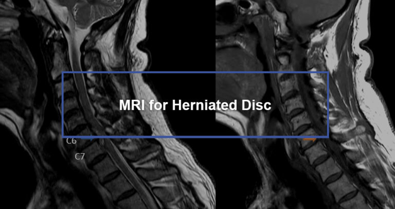 MRI for Herniated Disc - Dr. Kevin Pauza