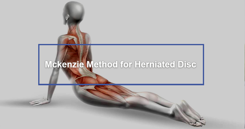 Mckenzie Method for Herniated Disc