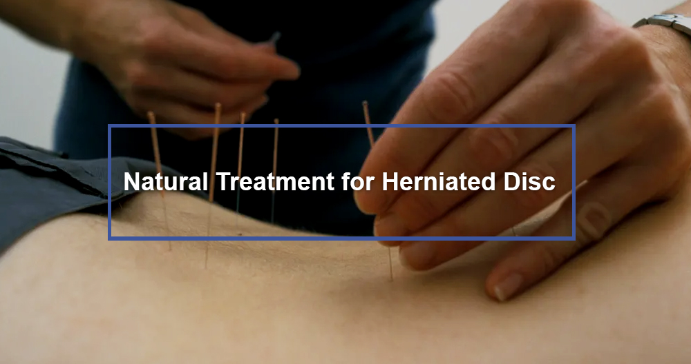 natural-treatment-for-herniated-disc-dr-kevin-pauza