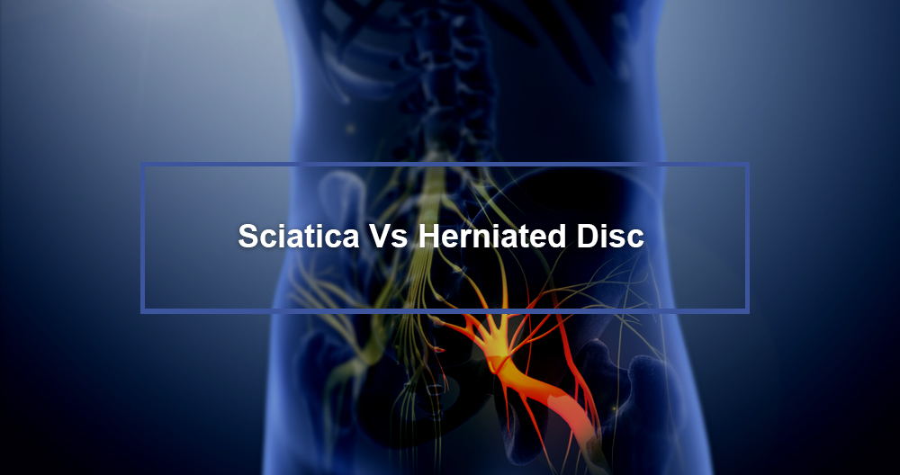 Sciatica Vs Herniated Disc
