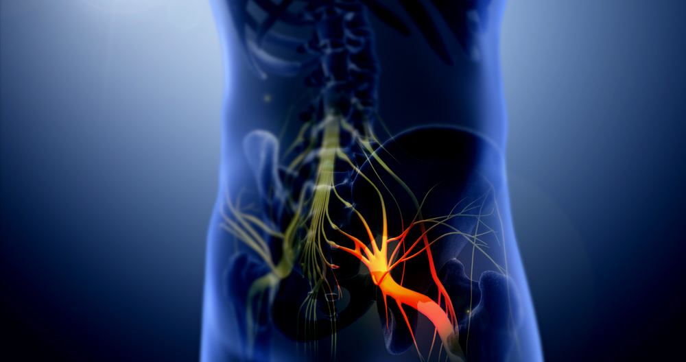 Sciatica: All You Should Know About Sciatic Nerve Pain